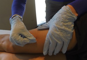 Dry Needling for IT Band and Anterior Knee Pain, Performed by Dr. Brown Budde