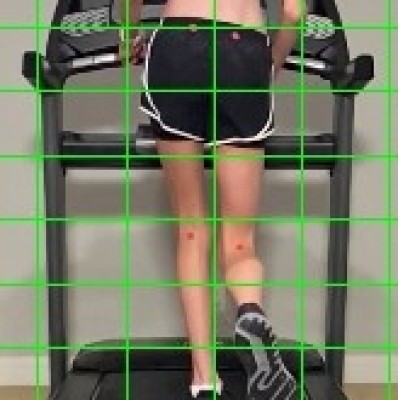 Case Study: taking care of chronic knee pain in young runner