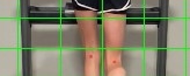 Case Study: taking care of chronic knee pain in young runner